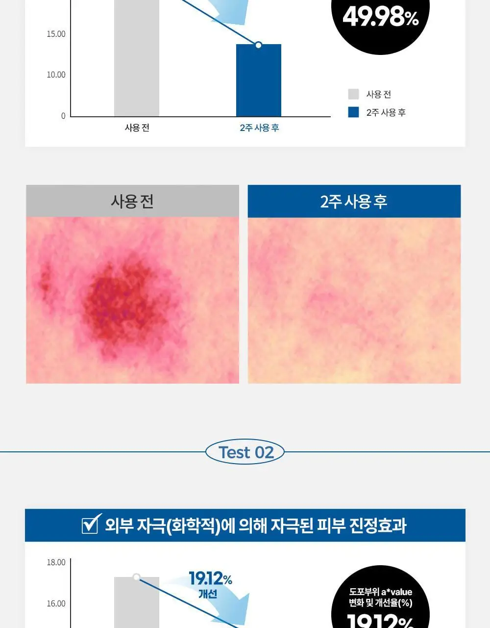 [피부장벽강화크림] 더하르나이 시카이드 밤 100ml기획(+앰플5ml*3p+크림5ml*2p) 상세페이지 7